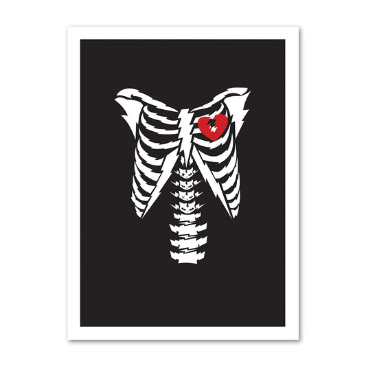 Bones